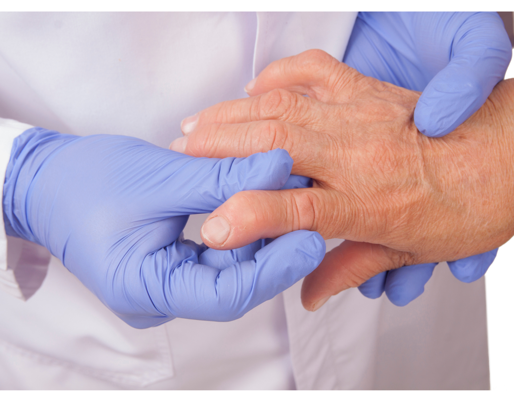 Ashwagandha has a pain releiving effect on inflammatory diseases such as Rheumatoid Arthritis.