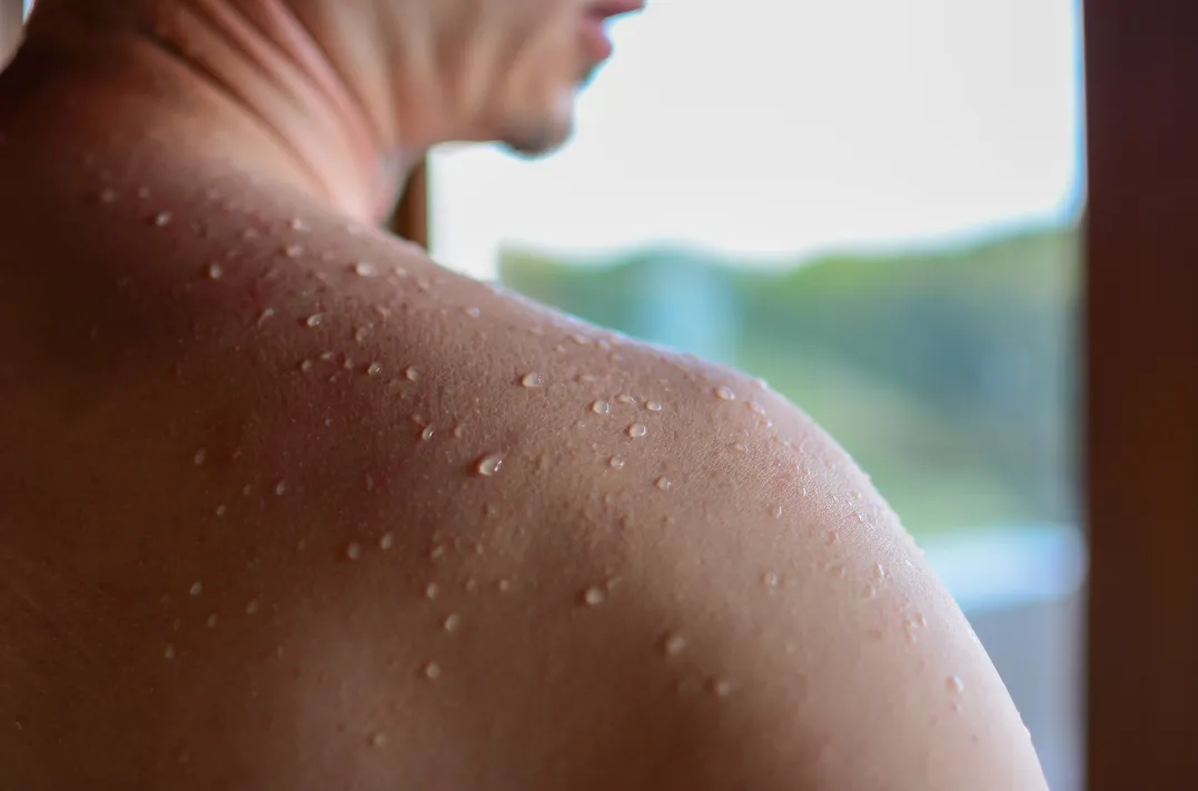 Infrared sauna light therapy induces sweating, which eliminates toxins and waste from the body.